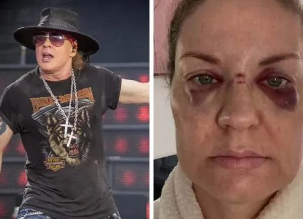 Une femme aurait été blessée par un lancer de micro d’Axl Rose lors d’un concert des Guns N’ Roses en Australie.