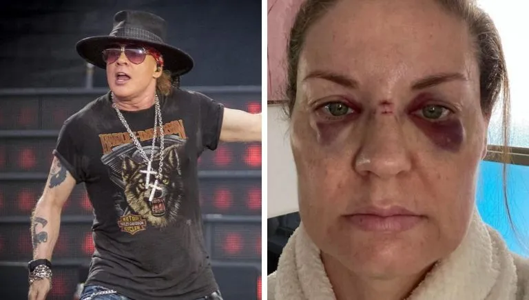 Une femme aurait été blessée par un lancer de micro d’Axl Rose lors d’un concert des Guns N’ Roses en Australie.